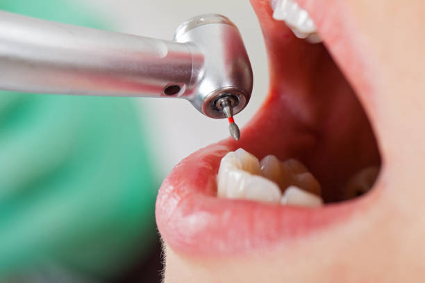 Best Emergency TMJ Treatment in Summitville, IN